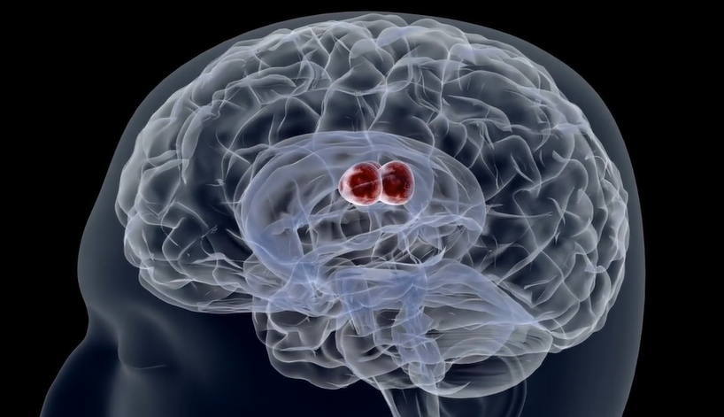 GammaTile “New Approach for the Treatment of Brain Tumors